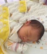 X女士甲状腺切除患者试管成功妊娠