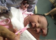 弱精男士多年无子 最终赴美试管成功