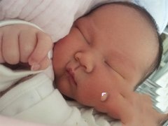 秦女士子宫多筋膜成功试管助孕